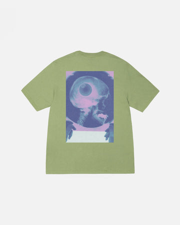 X-RAY TEE