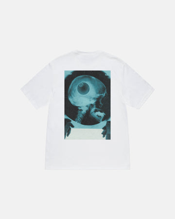 X-RAY TEE